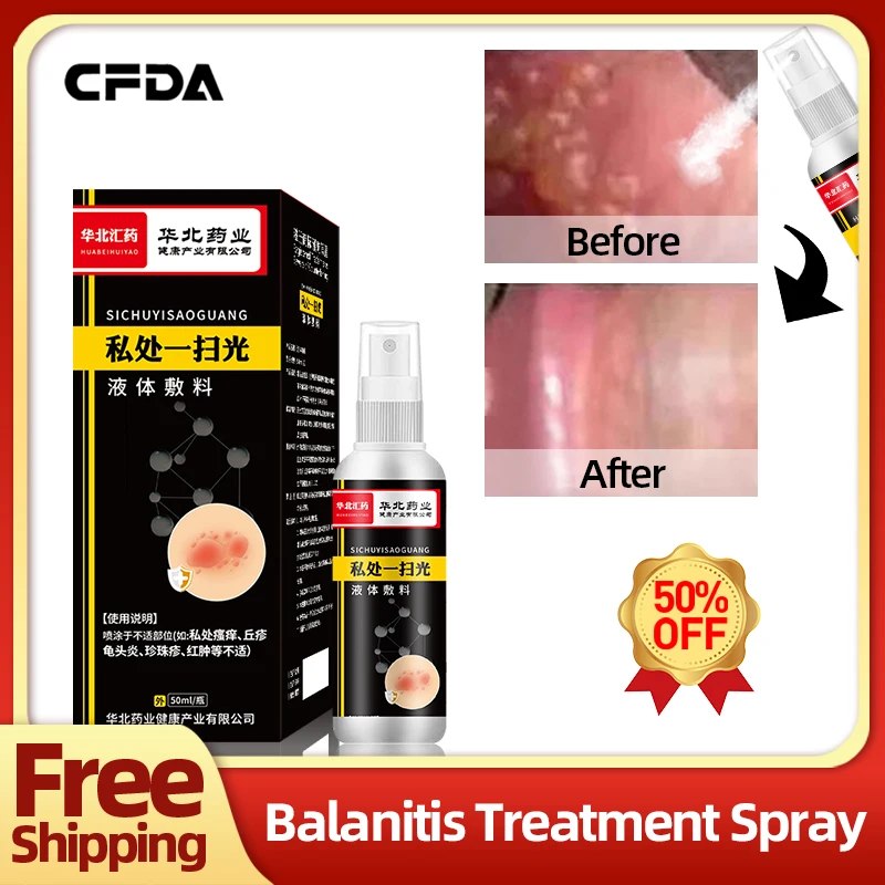 

Balanitis Medicine Papules Pearl Rash Cure Apply To Red White Dot Bacterial Infection 50ml/bottle Glans Treatment Medical Spray