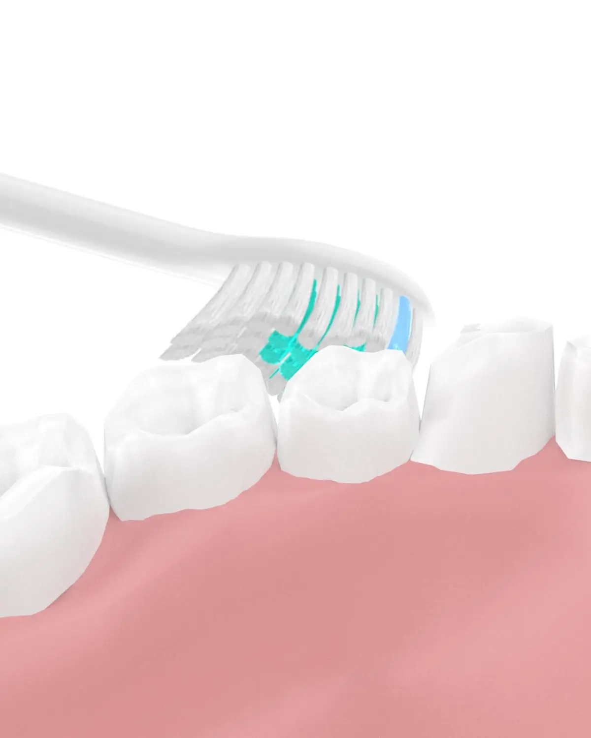 Cabeça de escova de dentes elétrica, 8 peças, ideal para philips sonicare e-series, hx7001, hx7002, hx7022, hx9500, hx9552, hx5910