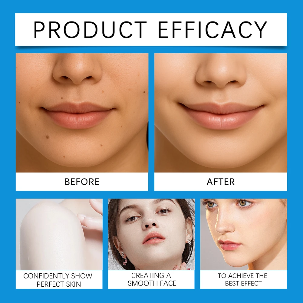 Thumbnail 4 - #36 Skin Care Extractors Comparison Guide