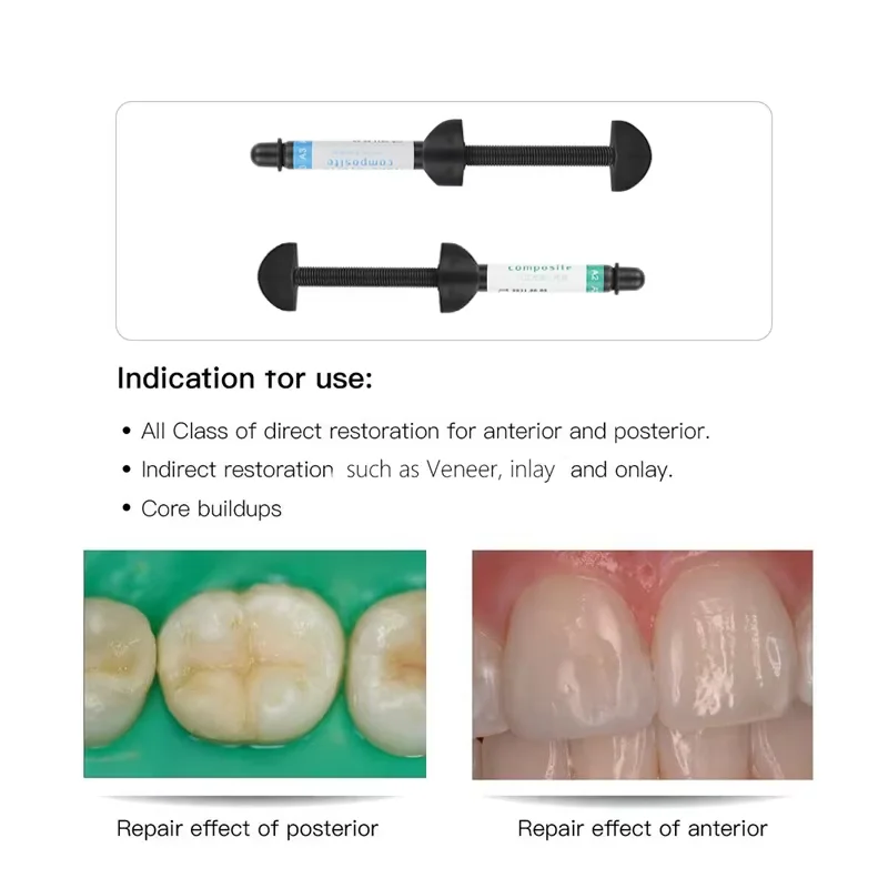 Dental Resin Light Curing Universal Shade Dentist Consumables Syringe Adhesive Bonding Dentist Material
