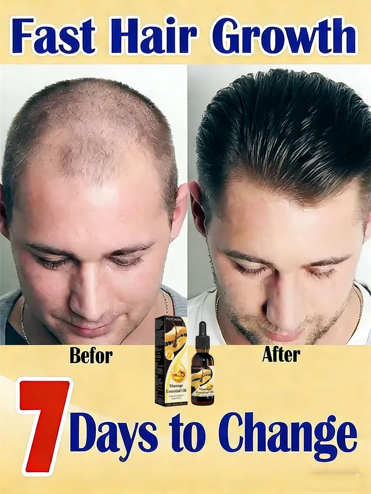 

Iᴛ ɴᴏᴜʀɪsʜᴇs ᴛʜᴇ ʜᴀɪʀ ʀᴏᴏᴛs, ɢɪᴠɪɴɢ ʏᴏᴜʀ ʜᴀɪʀ ᴀ ɴᴇᴡ sᴇɴsᴇ ᴏғ sᴛʀᴇɴɢᴛʜ, sᴍᴏᴏ