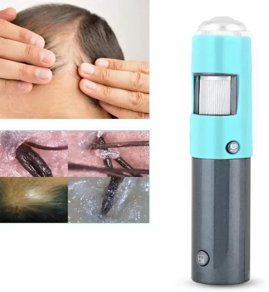 

HD magnification 600 times professional scalp skin analysis software hair detection hair follicle analysis scalp analyzer