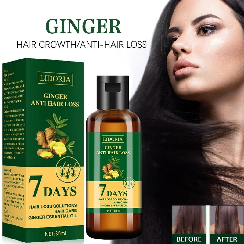 Productos para el crecimiento del cabello de jengibre, aceite esencial para el cabello de rápido crecimiento, anticaída Natural, previene el cabello seco, rizado, cuidado de reparación dañado