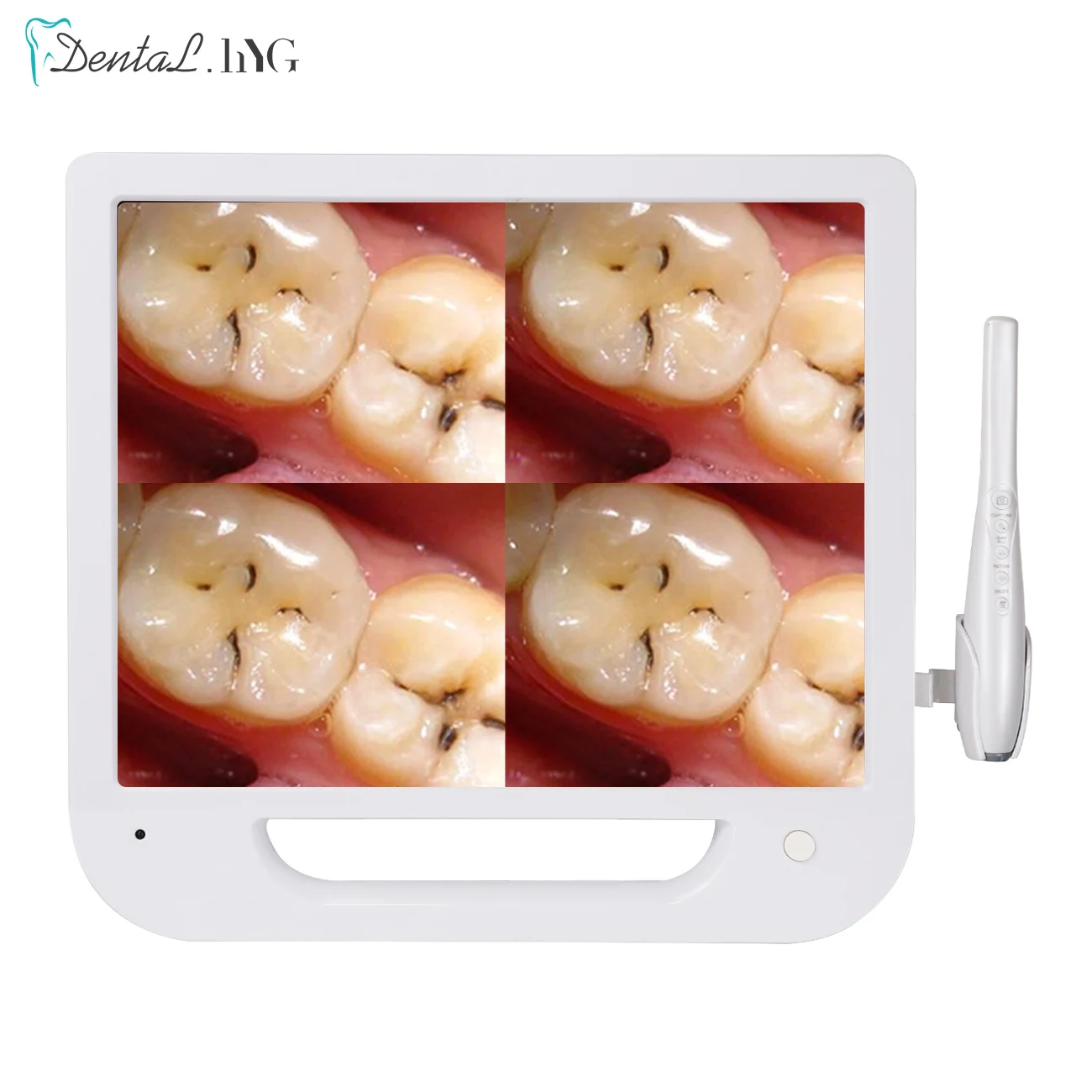 Dental Camera Wifi HD 8 Million Pixels High-definition Intraoral Camera 17 Inches Digital LCD Monitor Intraoral Instrument