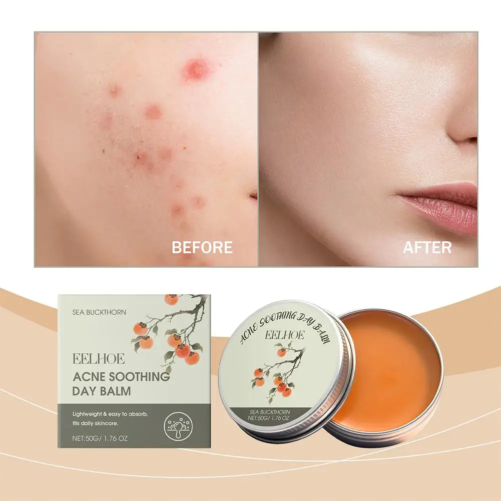 

Salicylic Acid Acne Removal Cream - Repair Pimple Spots, Soothe Redness, Deep Cleaning Pores, Anti-acne Scar & Moisturizing Face