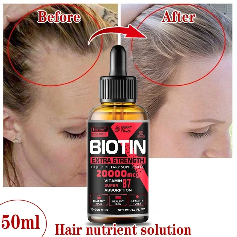 Fast Hair Growth Oil Hair Regeneration Essence Hair Thinning Treatment Hair Growth Fluid Anti-Hair Loss Care for Men and Women