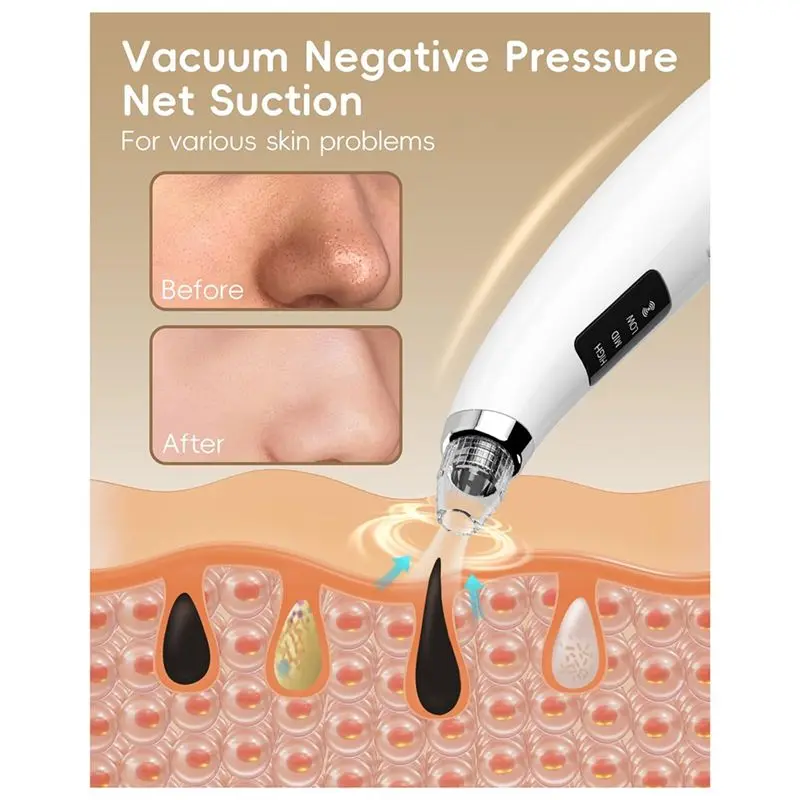 Factory NEW Blackhead Remover Tools Blackhead Remover Vacuum Extraction Tools Forestheticians