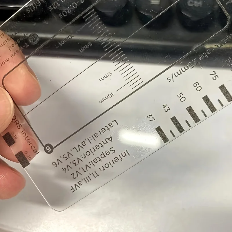 ECG 7 Step Ruler Heartbeat ECG Observation Step Ruler