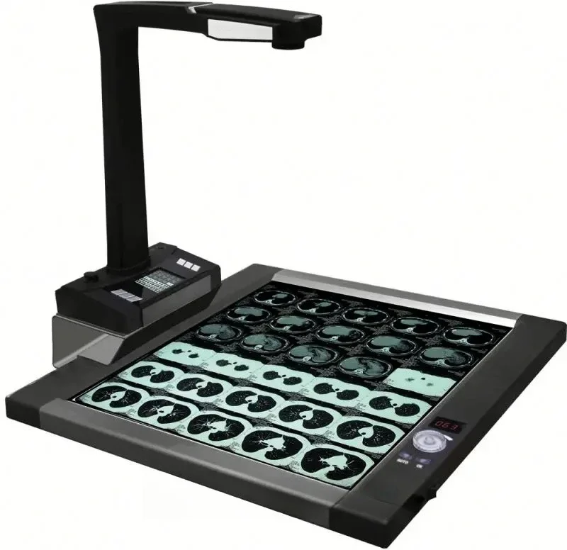 Scanner de filme de raios X Joyusing CT160 para diagnóstico hospitalar e clínico