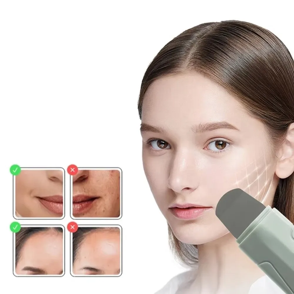 Deep Clean Facial Blackhead Removal Tool Remove Whitehead Acne Exfoliating Facial Hair Follicle Cleaner Handheld Sebum Remover