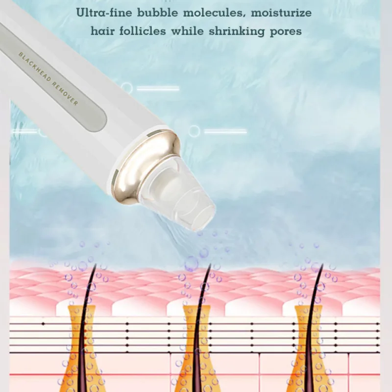 Elektrischer Porenreiniger für den Haushalt, USB-Aufladung, Hautpflege-Werkzeug zum Entfernen von Mitessern