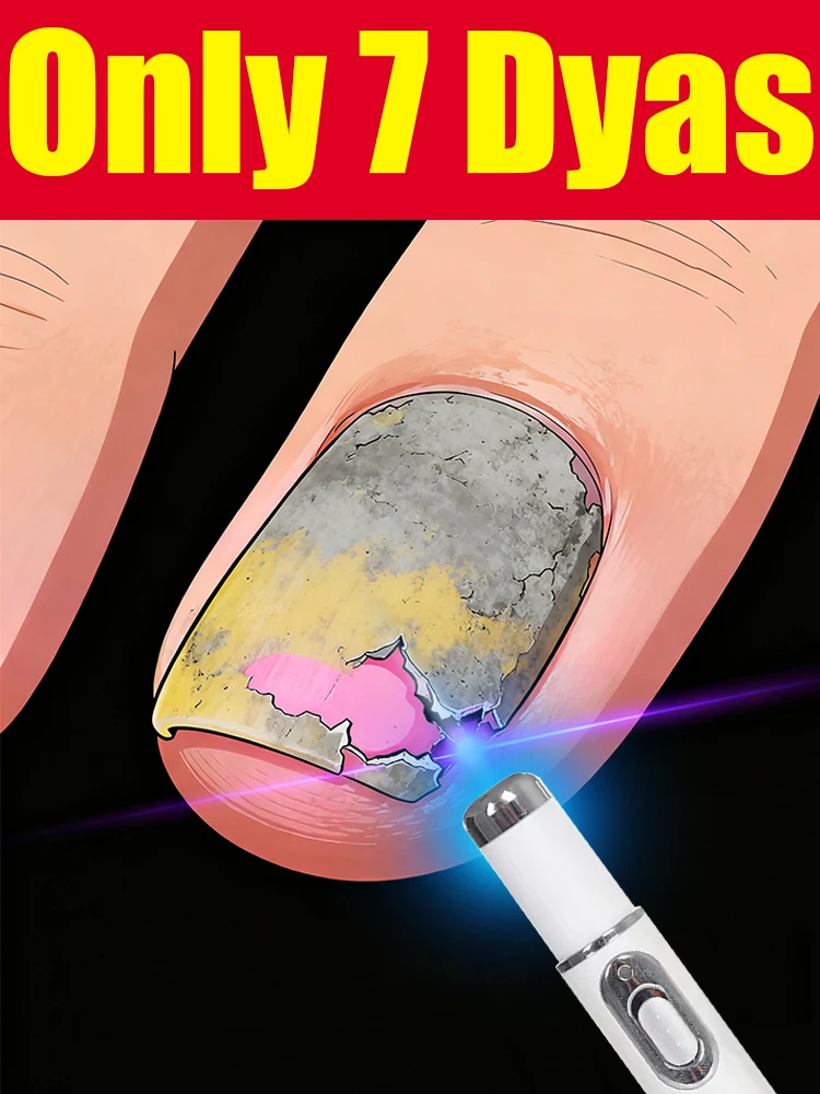 

Горячие продажи 2025 года: инструменты для чистки ногтей, лазерные инструменты с синим светом, ремонт корней, модернизированные до 2 поколений.