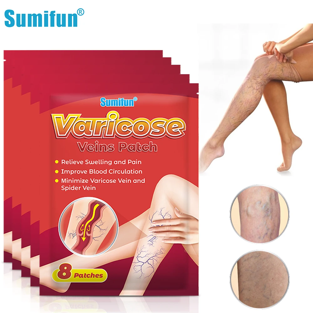 

40Pcs Varicose Veins Patch Remove Varicosity Angiitis Leg Spider Sticker Vasculitis Phlebitis Herbal Medical Health Care Plaster