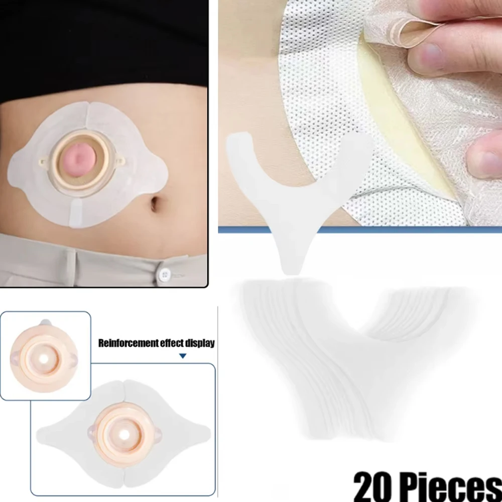 20Pcs/Box Ostomy Barrier Strips Y Shape Adhesive Seal Extender Strip For Colostomy Bags Ileostomy Tape For Stoma Ostomy Bag