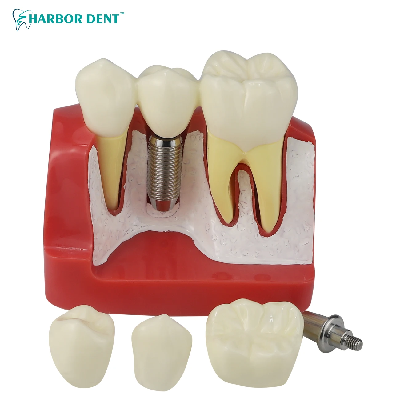 

Dental Teach Implant Analysis Crown Bridge Removable Model Dentist Demonstration Teeth Model Dentist Tools