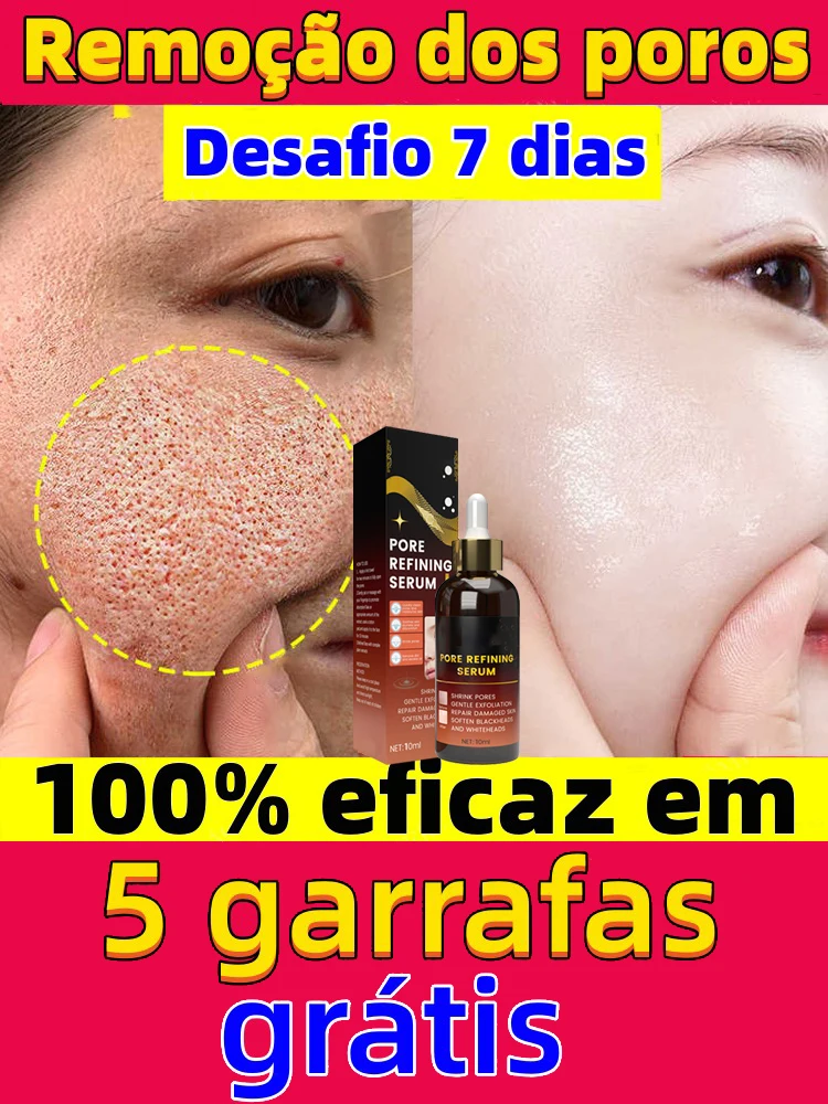 Removedor Eficaz De Poros Soro Encolhendo Poros, Encolher Aperto, Soro Minimizando, Produtos De Cuidados Com A Pele Facial, Tratamento De Acne