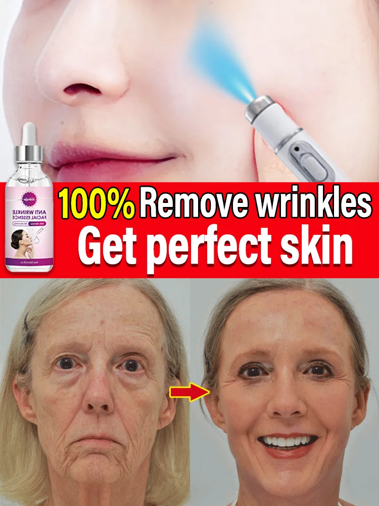 Solve all facial wrinkle problems