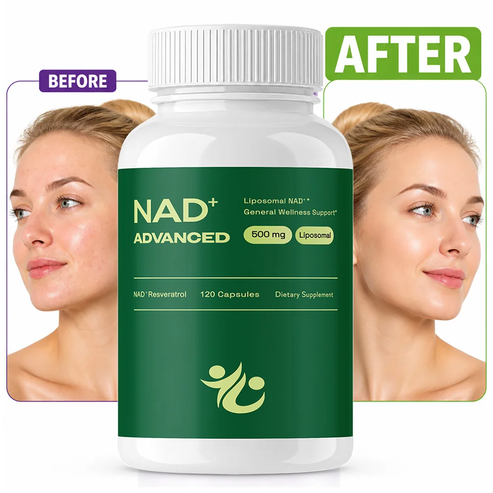 NAD+Supplement - Liposomal Nicotinamide Nucleoside Resveratrol - Used for Anti Aging, Energy, Focus