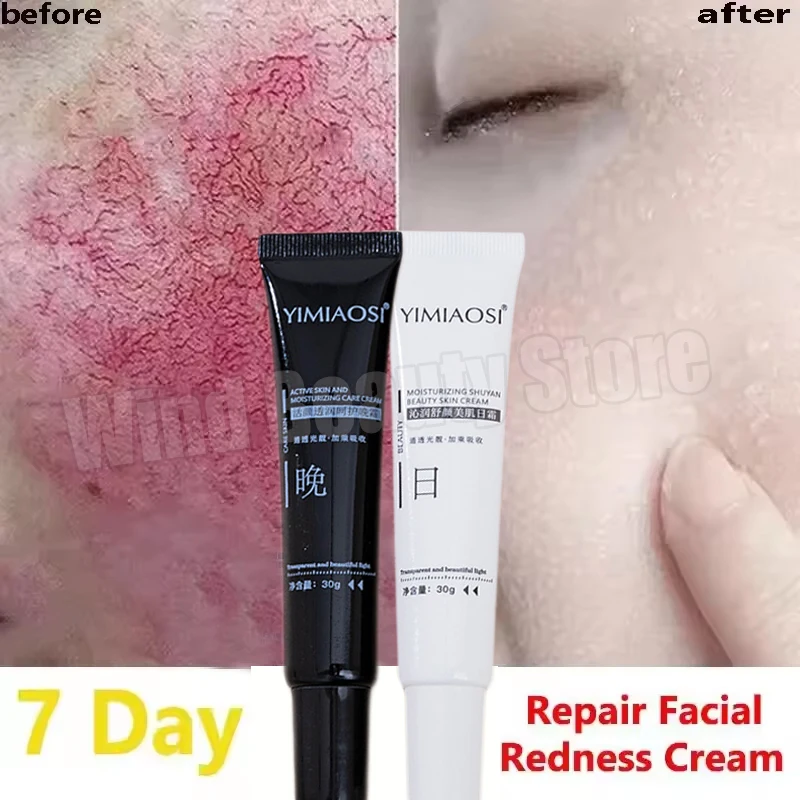 Crema reparadora de enrojecimiento Facial, mejora la sequedad de la piel sensible, loción calmante hidratante, eliminación de Rosacea, Cosméticos coreanos de día y noche