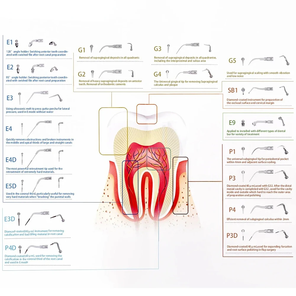 1Pcs AG Dental Ultrasonic Scaler Tips Scaling Periodontics Endo Perio Scaling Tip fit for EMS Woodpecker DTE NSK SATELEC Scalers