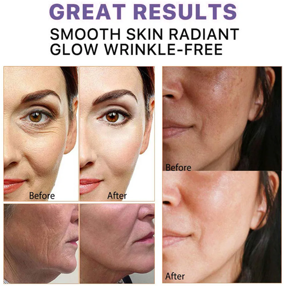 Instant Anti Wrinkle Cream Korean Face Cream Facial Whitening Cream Moisturizing Fades Fine Lines Lifting Firming Brighten Skin