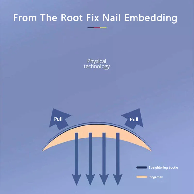 Outils de correction des ongles incarnés pour la pédicure - Outil professionnel de soin des pieds pour les ongles incarnés