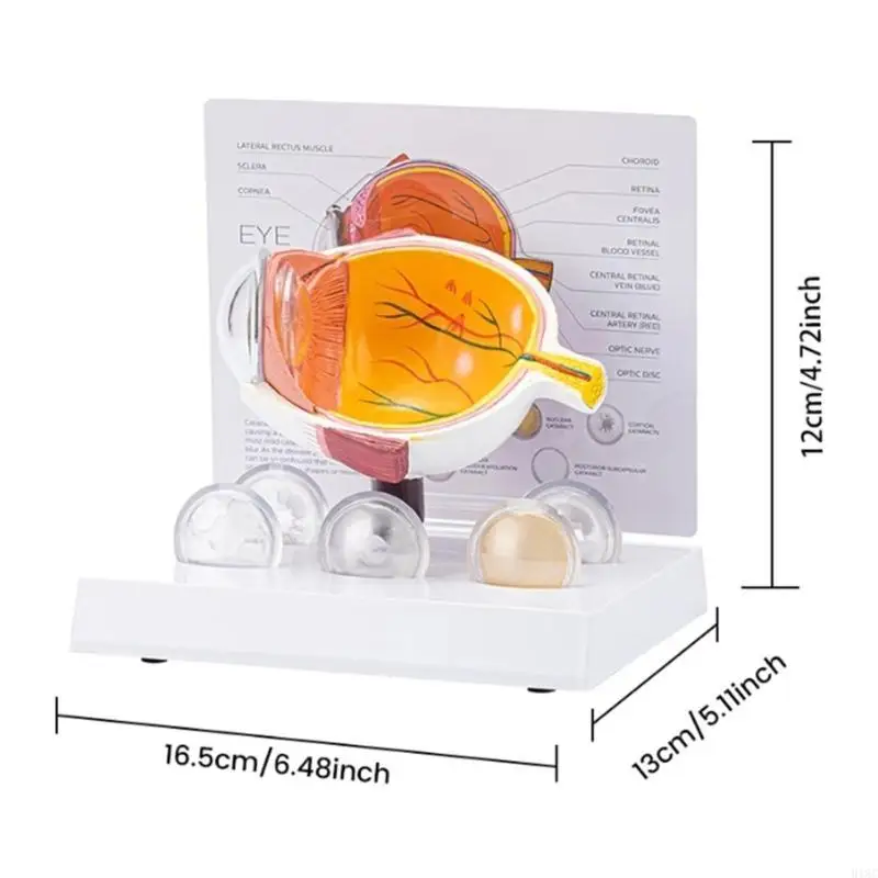 Menschliches pathologisches Augapfel Modell pathologisches Augapfel -Anatomie -Modell zum Unterrichten von Demonstration