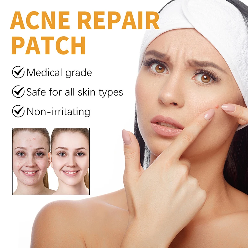 10 pz Acne Patch Riparazione Macchia Brufolo Strumento di Rimozione per il Viso Mento Fronte Traspirante Idrocolloide Adesivo Invisibile Cura Della Pelle