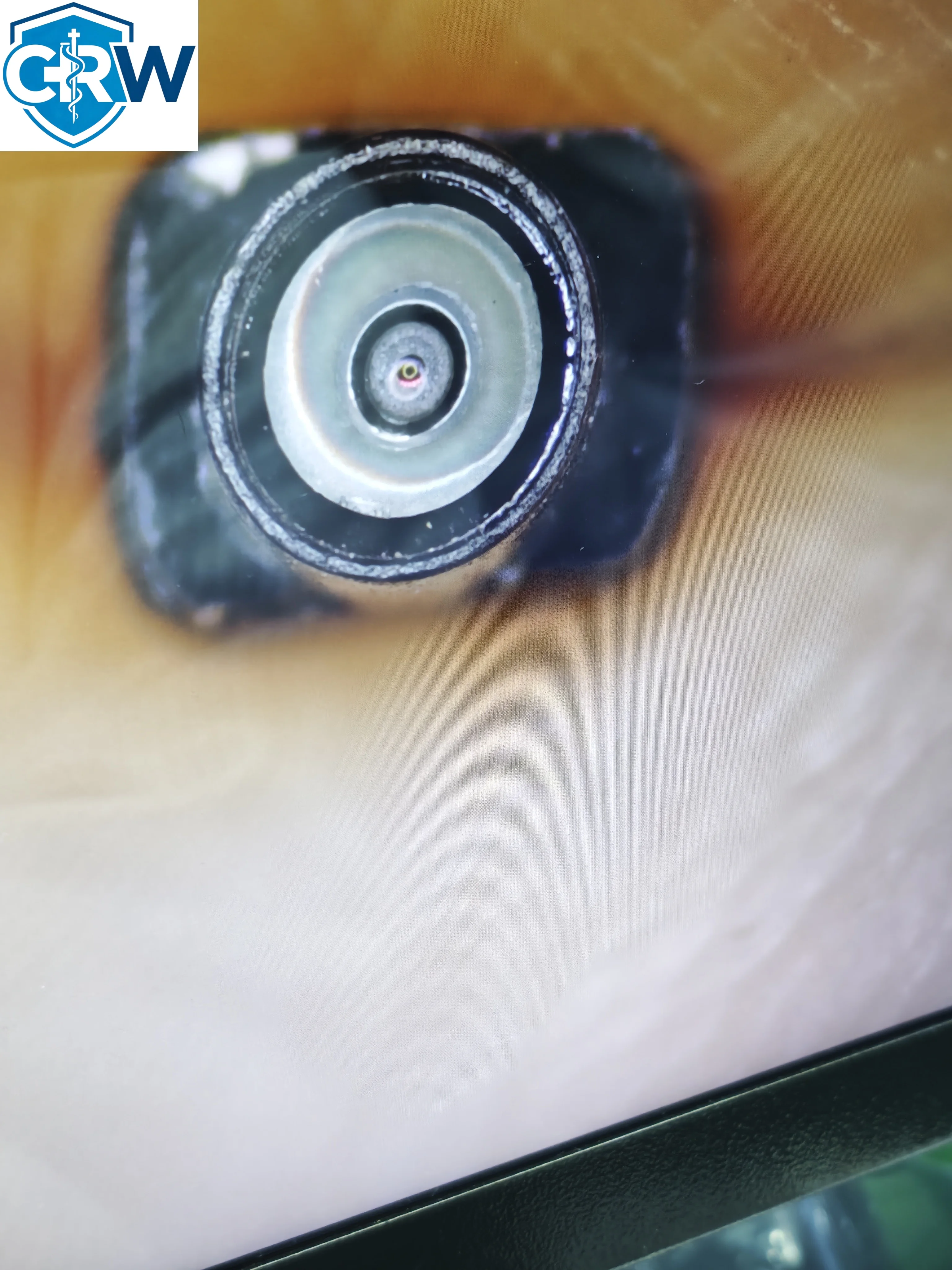CRW Veterinary USB Inspection Medical     Bronchoscope Hysteroscope   OVM9734 1280*720p Full HD