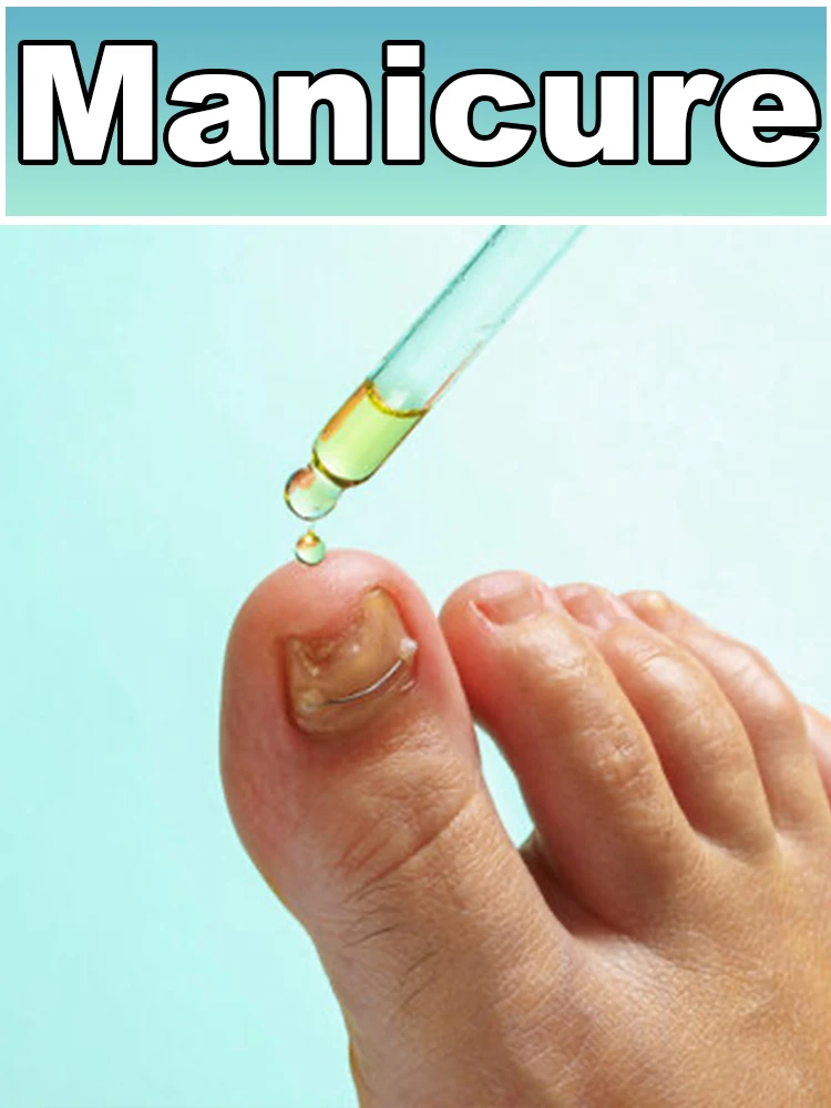 ²ⁿᵈ ᵍᵉⁿᵉʳᵃᵗⁱᵒⁿ ᵘᵖᵍʳᵃᵈᵉᵈ nᵃⁱˡ ᵒⁱˡ⸴ ʳᵉᵖaⁱʳ ⁿᵃiˡ rᵒᵒᵗ ᶠᵒˡˡⁱᶜˡᵉˢ⸴ ᑫᵘⁱᶜᵏˡʸ