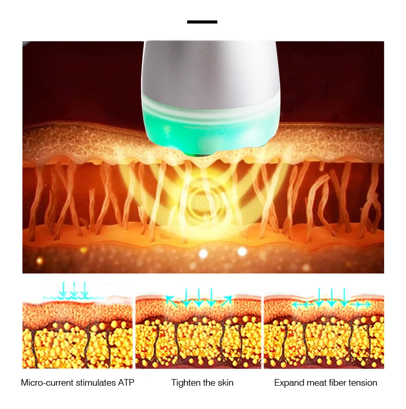 Appareil de mésothérapie sans aiguille par radiofréquence faciale Appareil de lifting RF Électroporateur facial Appareil de massage facial professionnel par radiofréquence