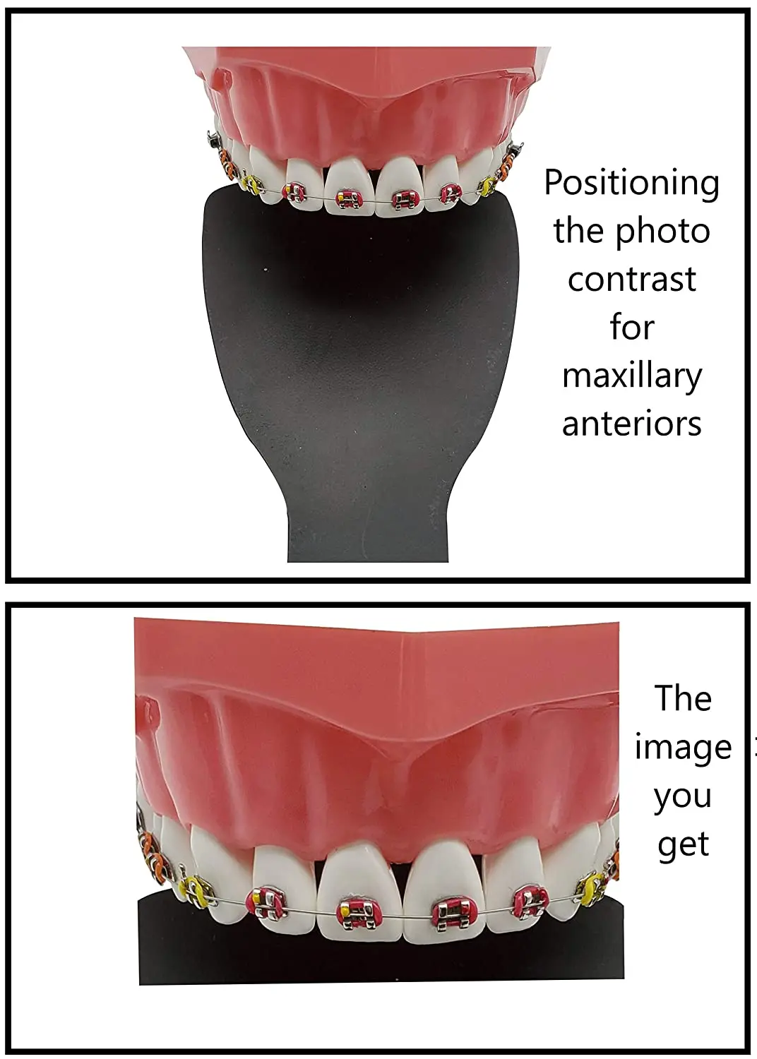 Dental Orthodontic Black Background Photo Image Contrast Board Oral Cheek Plate with Scale Mark Autoclavable Dentist Tools