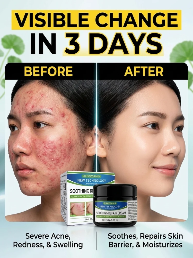 Soothing Barrier Repair Facial Cream, Mild Hydrating Skin Care Lotion, Calm Uncomfortable Skin Feeling, Nourish & Strengthen Skin Barrier for Sensitive Daily Facial Care