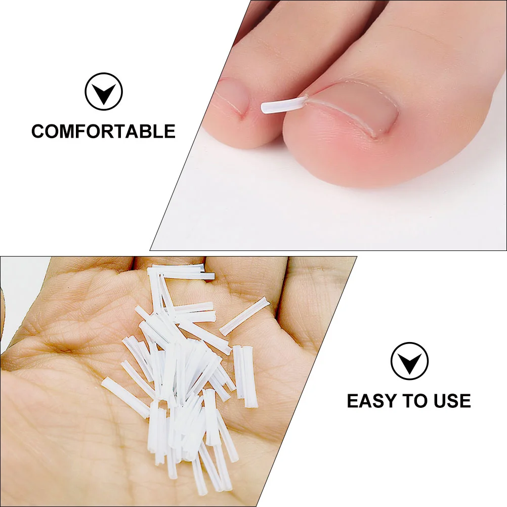 60 pezzi strisce per unghie incarnite imbottitura in plastica correttore patch strumento per il trattamento delle unghie spesse forniture per pedicure correzione della paronichia