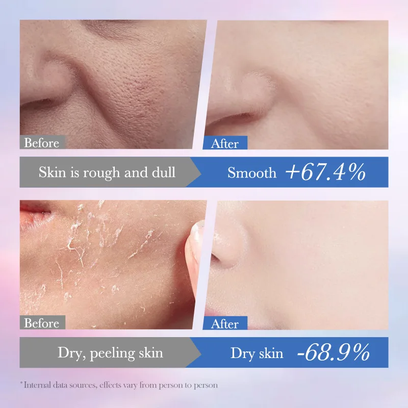 Essence Niacinamide Blanchissante pour la Peau, Taches de Rousseur Remoimplanté, Réparateur, Toner, Hydratant, Éclaircissant, Gratitude