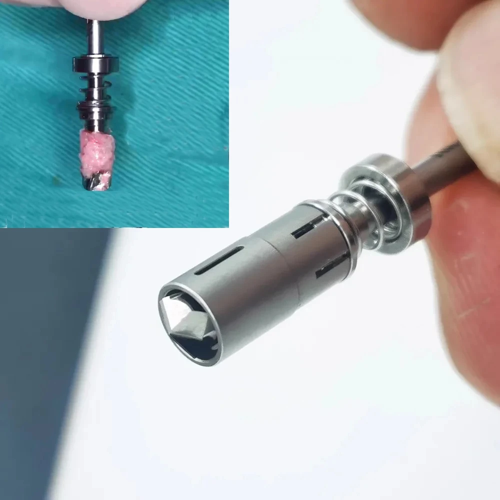 

Набор стоматологических инструментов для имплантации: сверла для удаления костной пыли, пружинные сверла для забора кости, самозаточающиеся сверла для экстракции кости