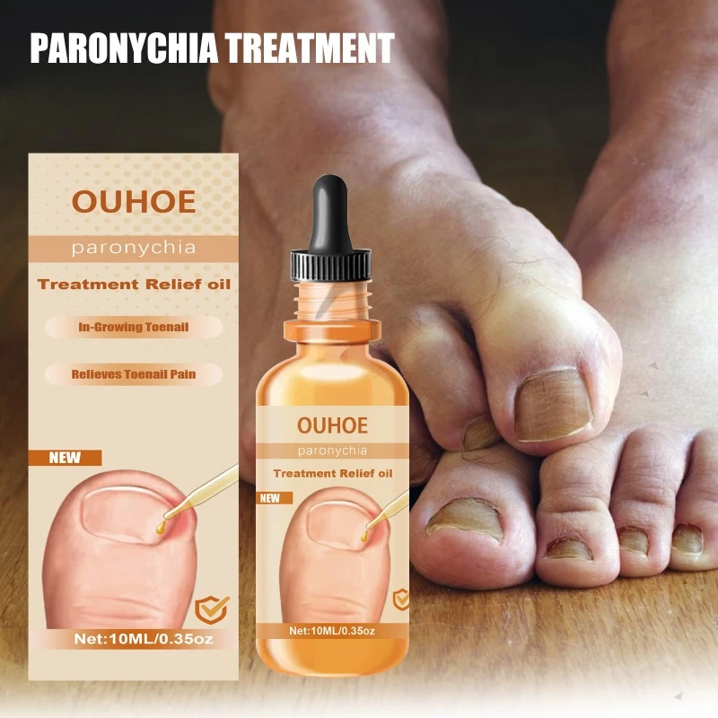 Anti-nail groove relief Essential oil repair ingrown toenail onychomycosis Fungal Treatment thickening soft nails Infection care