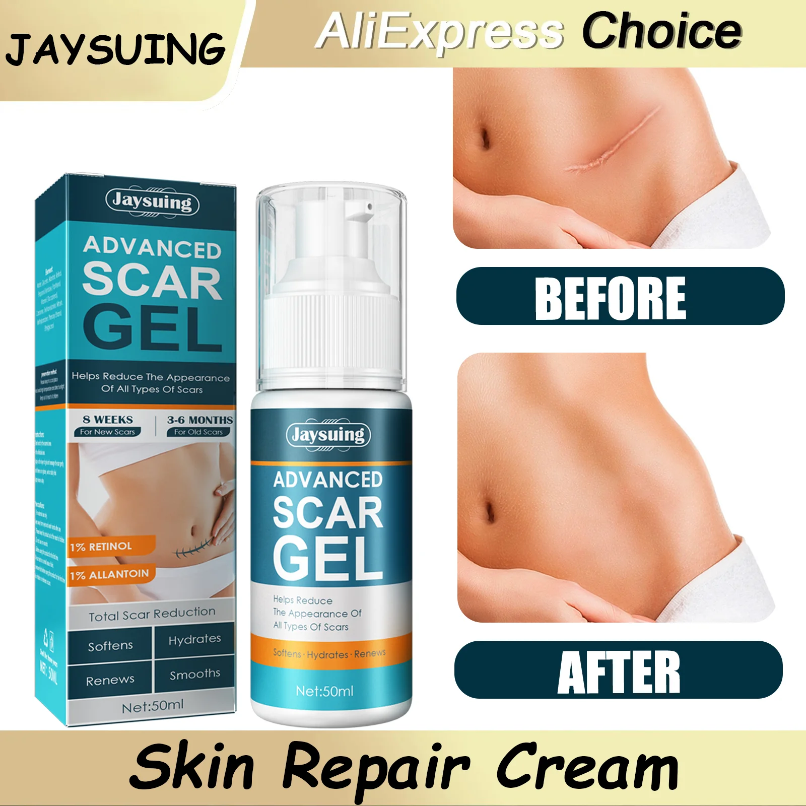 Skin Care Cream Scars Repair Gel Face Body Lotion Smoothing Hydrating Stretch Marks Cream Post Surgery Scar Care Gel Moisturize