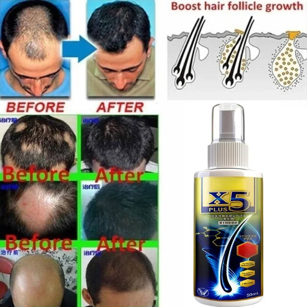 Hairloss Hair Natural Fast Growth Essential Oil Product Anti Hairloss Treatment Growth Essence Alopecia Hair Treatment for Women