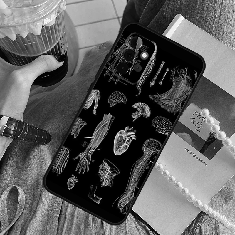 Radiological Human Organs Skeleton Funda Phone Case For Samsung Galaxy A14 A13 A12 A54 A53 A52 A34 A33 A32 A24 A23 A22 A51 A71