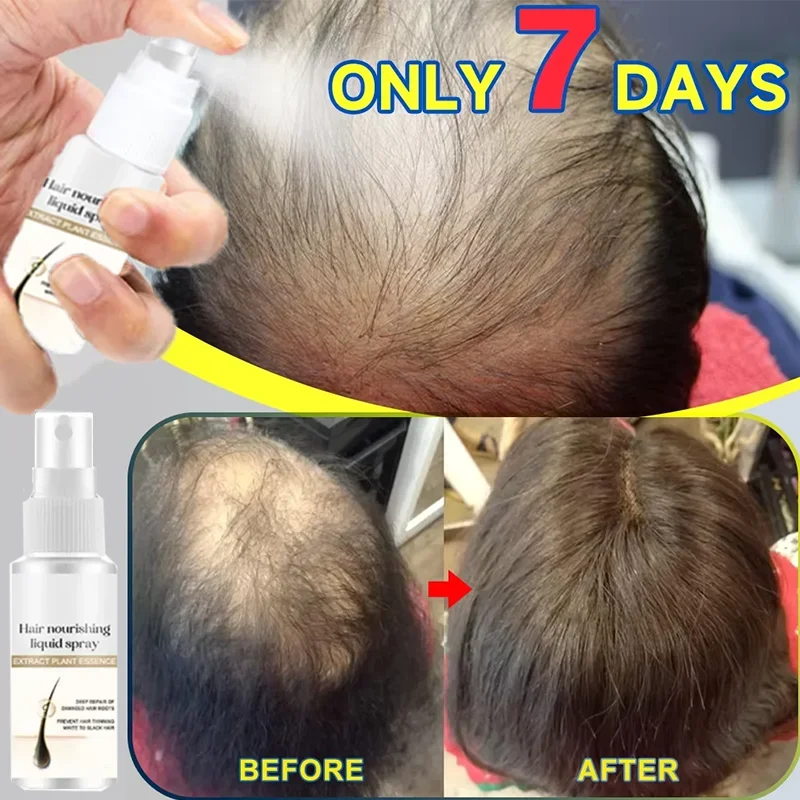 Hair Growth Products Biotin Anti Hair Loss Spray Scalp Treatment Fast Growing aHair Care Essential Oils for Men Women aHair Care