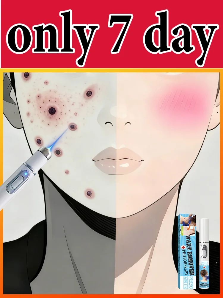 

Gᴇɴᴇʀᴀᴛɪᴏɴ-3 Lᴀsᴇʀ Sᴀʏs Gᴏᴏᴅʙʏᴇ Tᴏ Wᴀʀᴛs Iɴ 7 Dᴀʏs