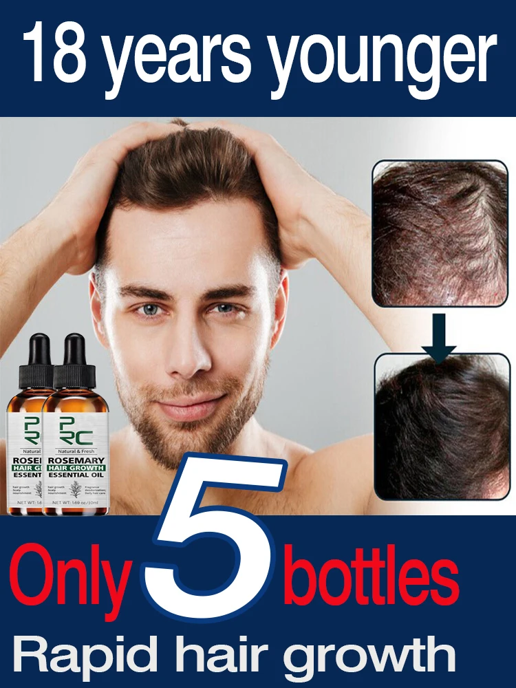 

Nurturing hair Reducing hair-loss and breakage Products Hair Growth Serum Anti-Hair Loss for Women and Men 77