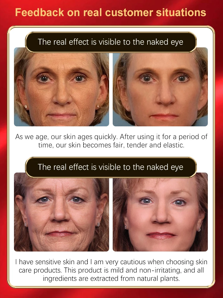 TODAS As Rugas desaparecem, 20 anos mais jovens.