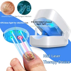 Nail Fungus Treatment Therapeutic Instrument Portable Painless Toenail Fungus Laser Therapy for Nails with Mushrooms