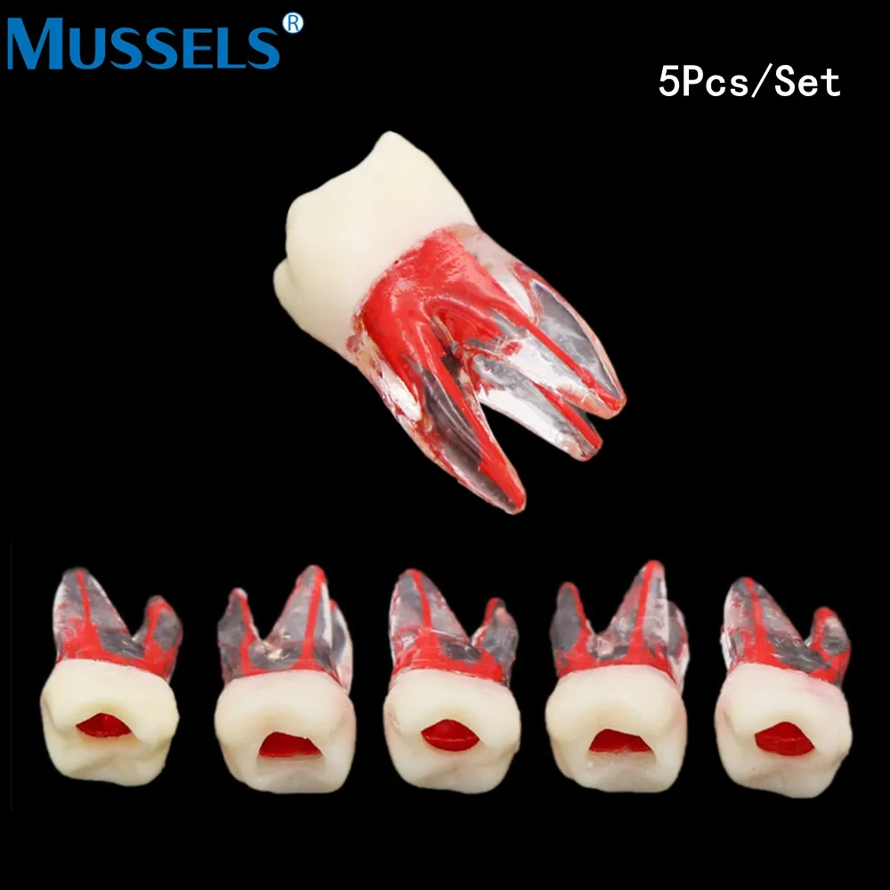 Endo Teeth Root Canal Model RCT Practice Block Endodontic File Pulp Cavity for Dentistry Teaching Study Resin Tooth Training