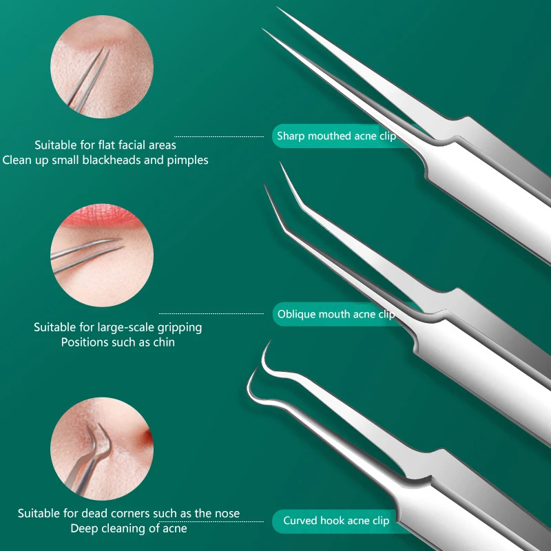 Pinzas de acero inoxidable para espinillas y acné, Clip para espinillas con tubo redondo, aguja para eliminar el acné, cuidado de la piel facial