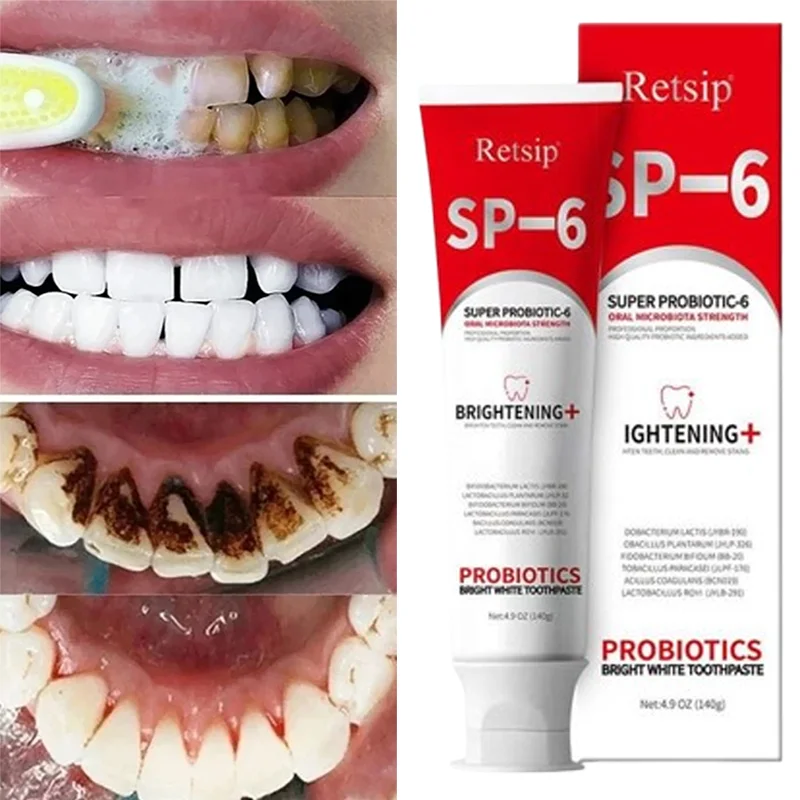 SP-6 Probiotic Toothpaste Whiten Tooth Remove Plaque Stains Oral Hygiene Clean Fresh Breath Protect Gum Teeth Care Products 2024