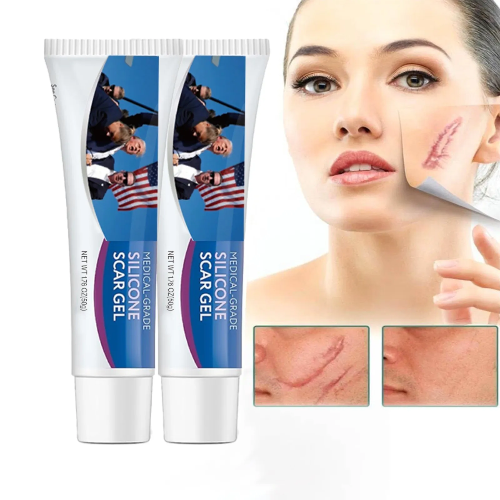 1/2/3pcs Scar Cream Advance Gel For Burns Acene Csection Stretch Marks Keloids Removal Cream For Old And New Suitable For Women