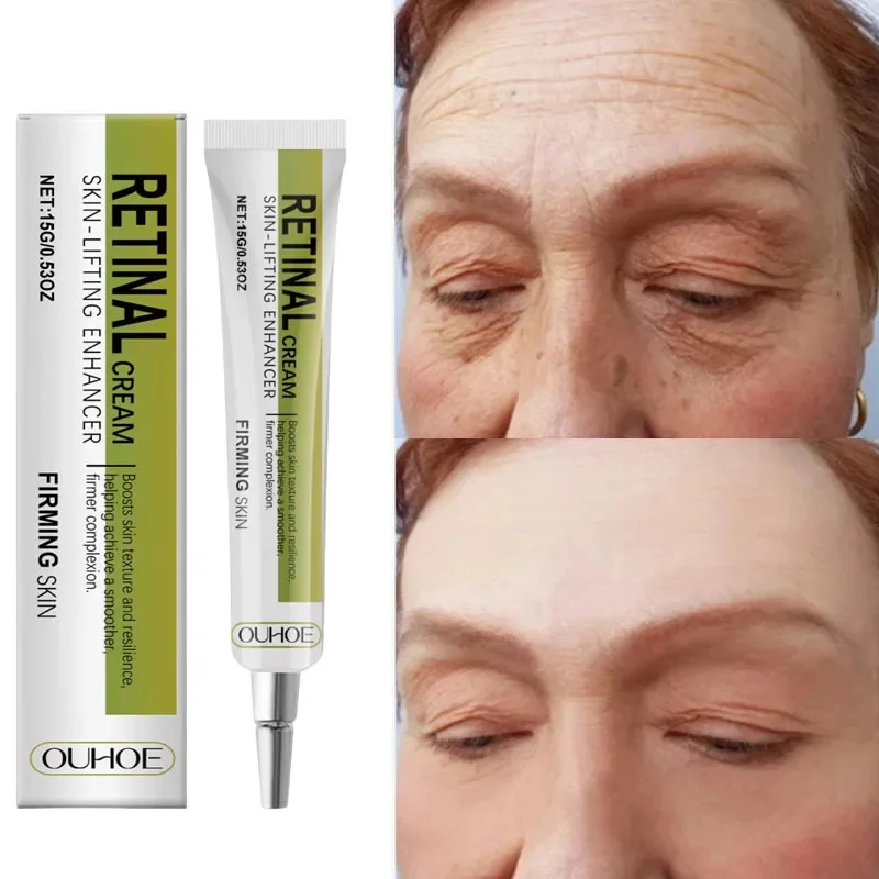 Retinol Cream Tightening Anti Wrinkle Improve Sagging Moisturizing Smoothing Lightening Firming Radiant Fine Lines Removal Cream